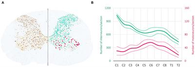 When Spinal Neuromodulation Meets Sensorimotor Rehabilitation: Lessons Learned From Animal Models to Regain Manual Dexterity After a Spinal Cord Injury